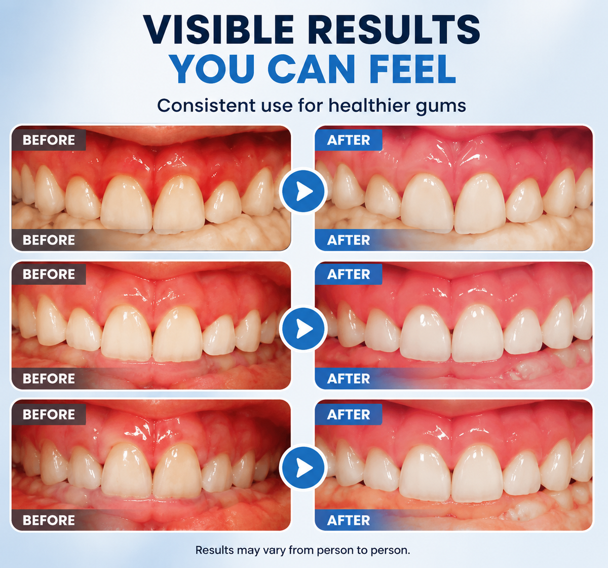 AQA® Gum Repair Gel