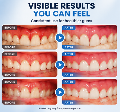 AQA® Gum Repair Gel